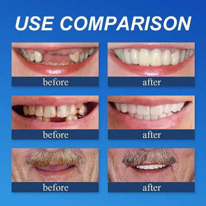 🎁🌎Ends Today: 70% OFF! ⏰LUMIVO™ Medical Full Denture with Strong Suctiond🦷Obtain American Dental Association (ADA) Certification